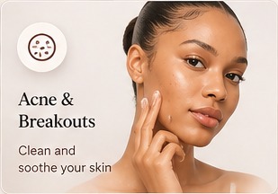 Caramel-skinned Nigerian woman showing acne-prone skin